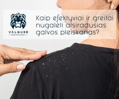 Kaip efektyviai ir greitai nugalėti atsiradusias galvos pleiskanas
